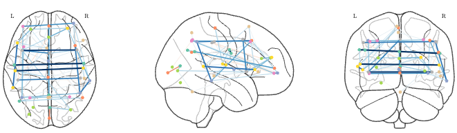 Optimization and Statistical Learning